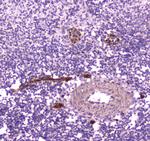 CD163 Antibody in Immunohistochemistry (Paraffin) (IHC (P))