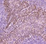 CD163 Antibody in Immunohistochemistry (Paraffin) (IHC (P))