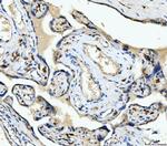 CD163 Antibody in Immunohistochemistry (Paraffin) (IHC (P))