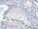 CD163 Antibody in Immunohistochemistry (Paraffin) (IHC (P))