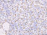 CD163 Antibody in Immunohistochemistry (Paraffin) (IHC (P))