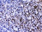 CD2 Antibody in Immunohistochemistry (Paraffin) (IHC (P))