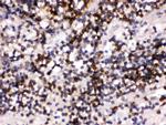 CD22 Polyclonal Antibody
