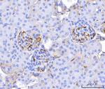 CD34 Antibody in Immunohistochemistry (Paraffin) (IHC (P))