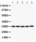 CD154 (CD40 Ligand) Antibody in Western Blot (WB)