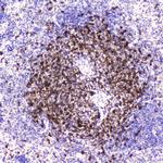 CD5 Antibody in Immunohistochemistry (Paraffin) (IHC (P))