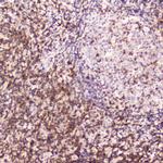 CD5 Antibody in Immunohistochemistry (Paraffin) (IHC (P))