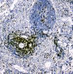 CD5 Antibody in Immunohistochemistry (Paraffin) (IHC (P))