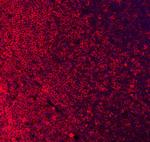 CD79a Antibody in Immunohistochemistry (IHC)