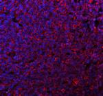 CD80 (B7-1) Antibody in Immunohistochemistry (Paraffin) (IHC (P))