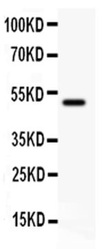 CD80 (B7-1) Antibody in Western Blot (WB)