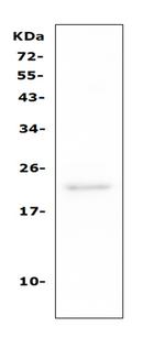 CD81 Antibody in Western Blot (WB)