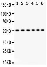 CD8 alpha Antibody in Western Blot (WB)