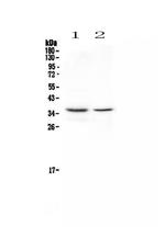 CD8 alpha Antibody in Western Blot (WB)