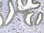 CDC20 Antibody in Immunohistochemistry (Paraffin) (IHC (P))