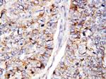 CDC25B Polyclonal Antibody