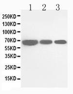 CDC25B Antibody in Western Blot (WB)