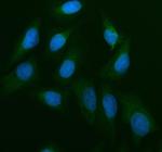 CDC25B Polyclonal Antibody
