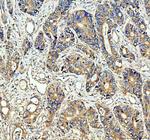 CDC25B Antibody in Immunohistochemistry (Paraffin) (IHC (P))