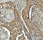 CDK2 Antibody in Immunohistochemistry (Paraffin) (IHC (P))