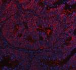 CDK4 Polyclonal Antibody