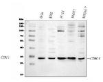 CDK4 Antibody in Western Blot (WB)
