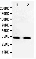 CDK5 Polyclonal Antibody