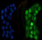 C/EBP beta Polyclonal Antibody