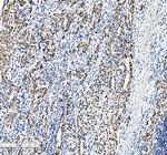 C/EBP beta Antibody in Immunohistochemistry (Paraffin) (IHC (P))