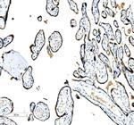 C/EBP beta Antibody in Immunohistochemistry (Paraffin) (IHC (P))