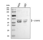 C/EBP beta Antibody in Western Blot (WB)