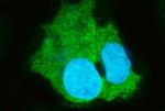 CES1 Polyclonal Antibody