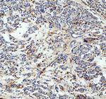 Factor D Polyclonal Antibody