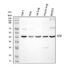 Factor D Antibody in Western Blot (WB)