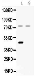 Complement Factor I Polyclonal Antibody