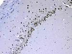 CHD2 Antibody in Immunohistochemistry (Paraffin) (IHC (P))