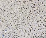 CHD2 Polyclonal Antibody