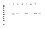 CHRNA3 Polyclonal Antibody