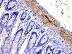 CHRNA5 Antibody in Immunohistochemistry (Paraffin) (IHC (P))