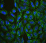 CIS Polyclonal Antibody