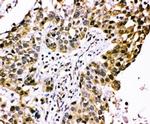 CIS Antibody in Immunohistochemistry (Paraffin) (IHC (P))