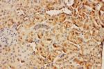 CIS Antibody in Immunohistochemistry (Paraffin) (IHC (P))