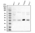 CIS Antibody in Western Blot (WB)