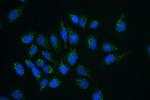 CLPX Polyclonal Antibody