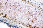 Collagen II Polyclonal Antibody