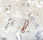 COL4A2 Polyclonal Antibody