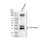 COL4A2 Antibody in Western Blot (WB)