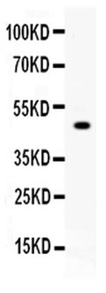 Carboxypeptidase B2 Polyclonal Antibody