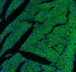 CPT1B Antibody in Immunohistochemistry (Paraffin) (IHC (P))