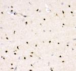 CRK Antibody in Immunohistochemistry (Paraffin) (IHC (P))